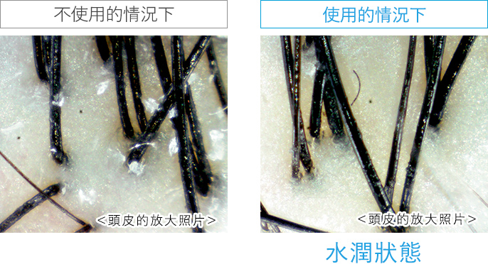美麗的頭髮從打造健康的頭皮開始